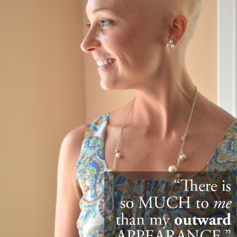 I Am More Than My Hair: Bald and Beautiful Me